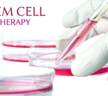 Role of Stem Cell Treatment in Combating Chronic Diseases