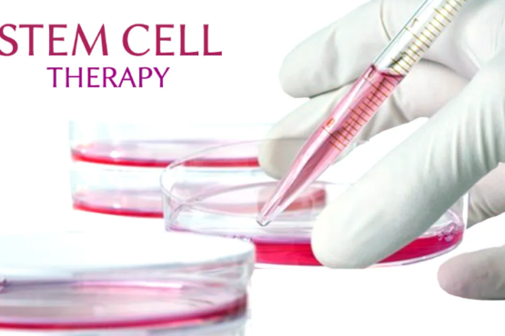 Role of Stem Cell Treatment in Combating Chronic Diseases